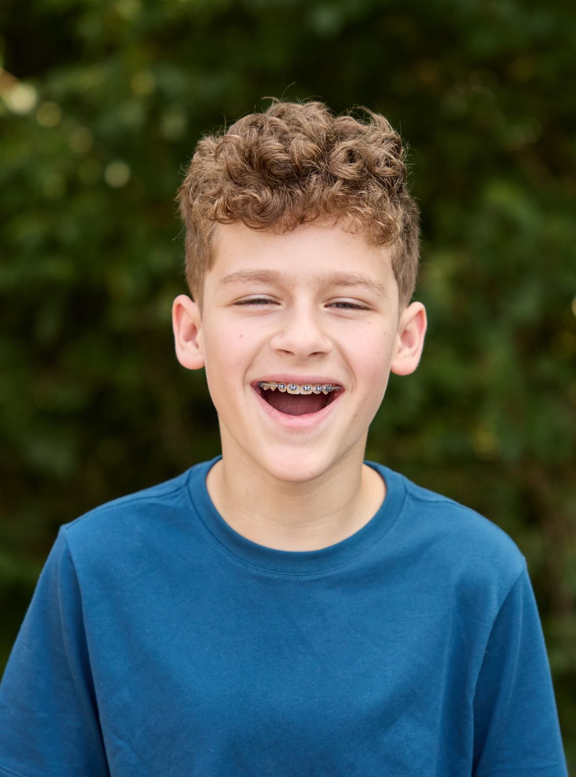 child laughing with braces